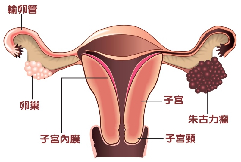 子宫示意图