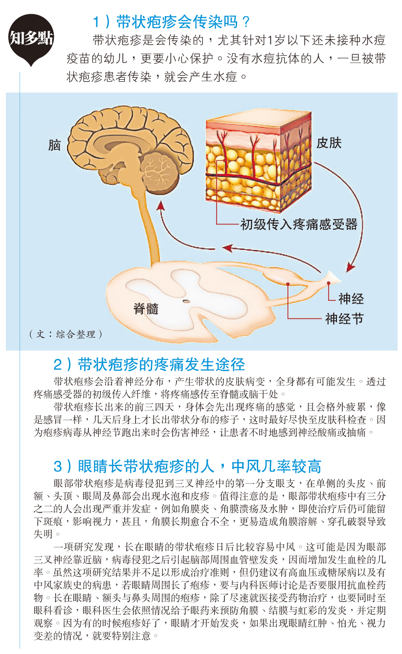 带状疱症