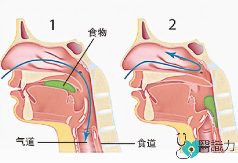 星洲日报，活力副刊，养生，言语发育，听力障碍，吞咽障碍