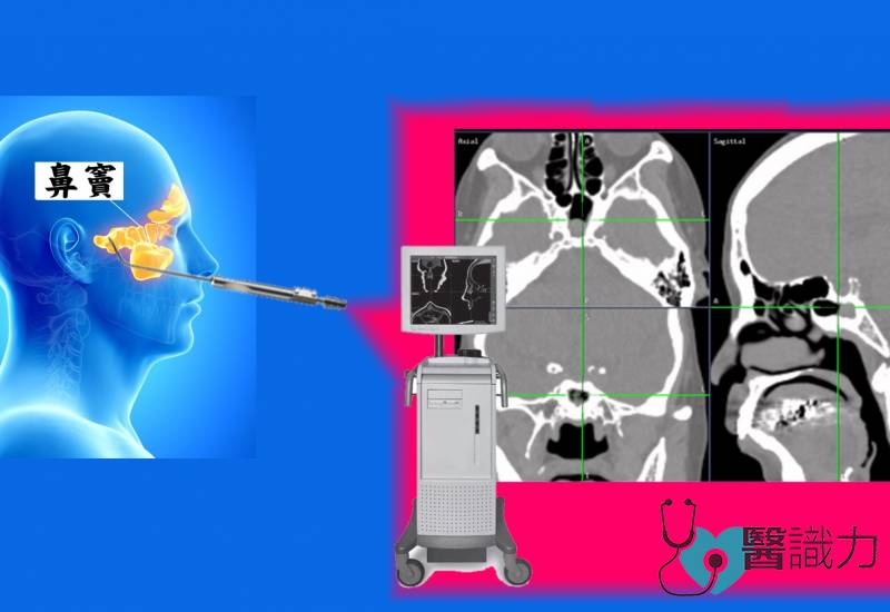 星洲日报，医识力，长庚医院，鼻内视镜，微创手术