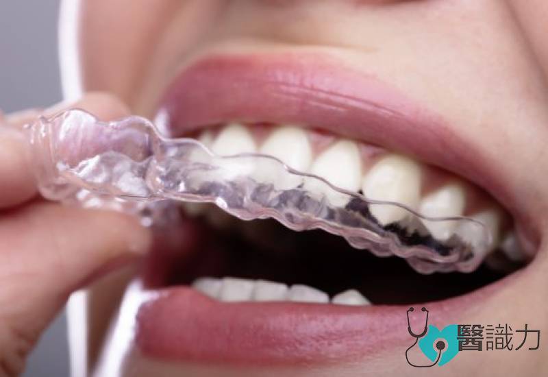 问医, 侯锦泉, 隐形牙套, 传统托槽, 牙齿矫正, clear aligners, braces